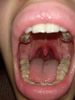 Img_20200308_210521_178